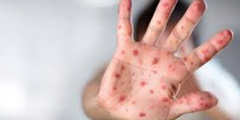 БАЛА САУЛЫҒЫ – БАСТЫ ҚҰНДЫЛЫҚ