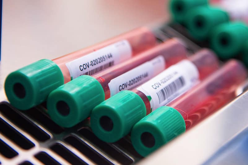 Коронавирусқа қарсы вакцина 2021 жылдың бірінші жартысында нарыққа шығады